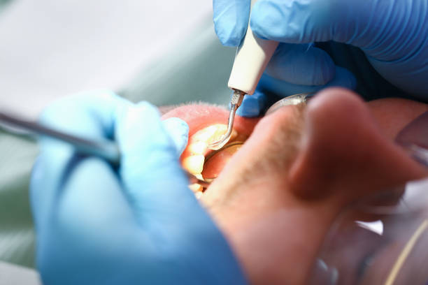 Best Emergency Dental Care for Broken or Chipped Teeth in Hales Corners, WI
